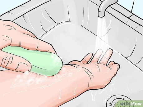 tratamiento para picadura de mosquito